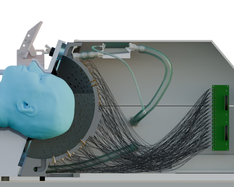 Casque à ultrasons pour la maladie de Parkinson : traitement sûr selon une étude