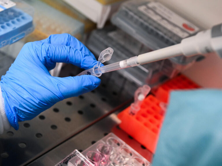 Nouveaux médicaments promettent une percée dans le traitement du cancer du pancréas